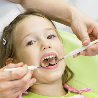 A Guide to Dental Sealants and Their Benefits for Oral Health